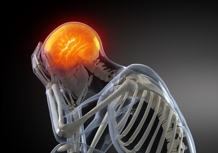 Head Pain migraine concept