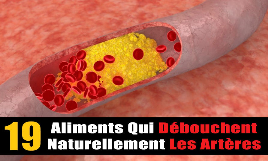 19-aliments-debouchent-arteres