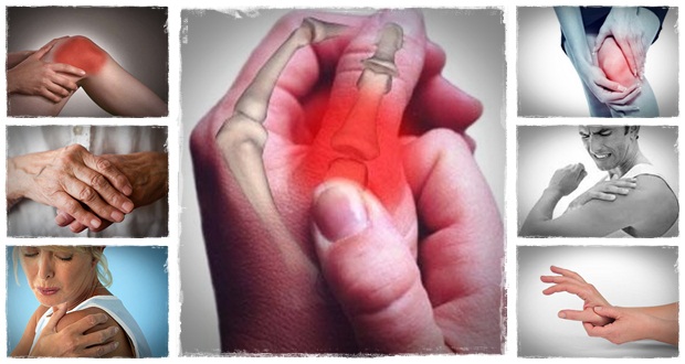 arthrite
