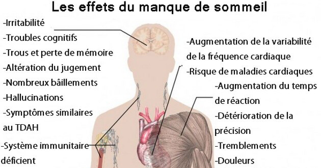 Manque-de-sommeil-danger2