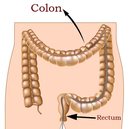 colon7
