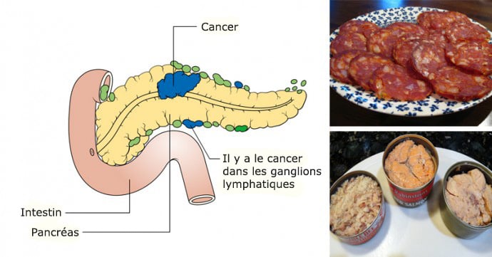 aliments-cancerigenes
