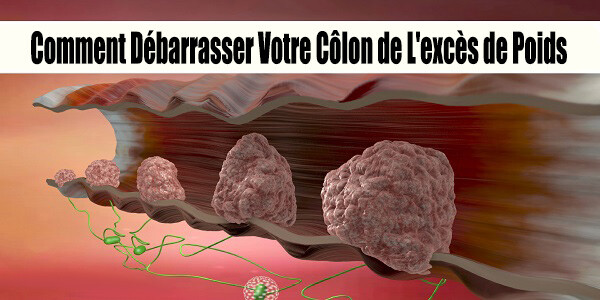 colonpoids