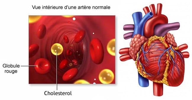 cholesterol-coeur2