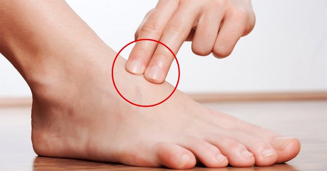 Les médecins avertissent : 10 signes silencieux que vos artères de jambes sont obstruées