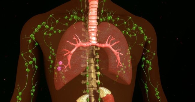 10 moyens immédiats de détoxifier votre système lymphatique et éliminer les toxines qui vous rendent malade