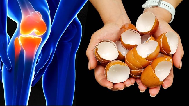 🥚Ma mère ne pouvait PAS marcher à cause de DOULEURS aux genoux et aux os, jusqu'à ce qu'elle essaie ! 🤩