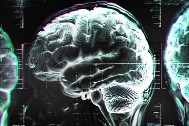 Scientists Just Found a Major Problem With Vitamin B12 Guidelines – And Your Brain Might Be at Risk