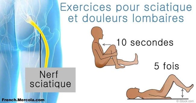 Exercices pour la sciatique - Santé Nutrition
