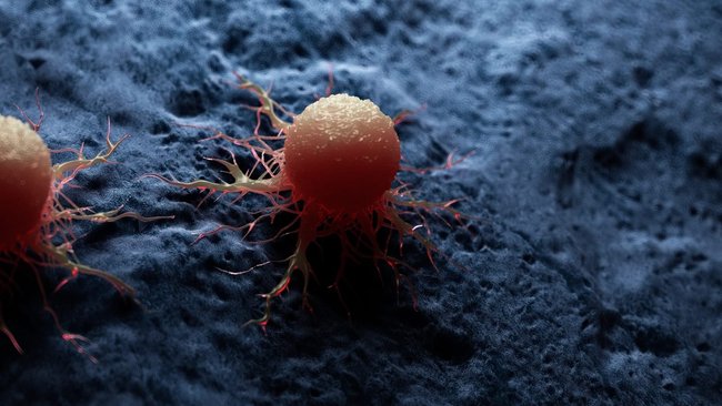 Quand les signes précurseurs du cancer sont ignorés