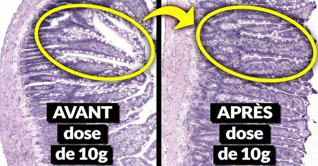 Ce complément alimentaire bon marché soigne le syndrome de l'intestin perméable après une seule prise