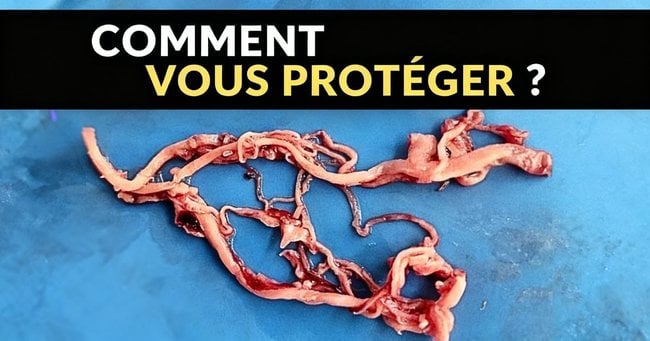 Des caillots amyloïdes découverts chez CHAQUE PERSONNE : nouvelle étude