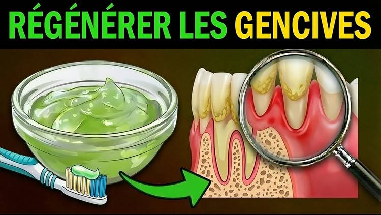 7 secrets pour la régénération des gencives que votre dentiste ne vous dévoilera pas