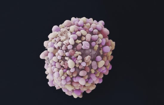 À lire avant de subir une biopsie