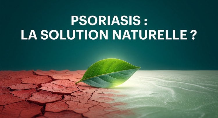 Comment soigner le psoriasis naturellement