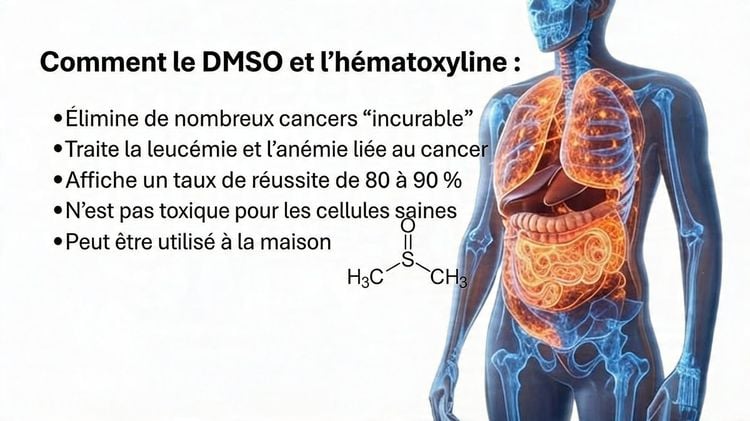 Le remède contre le cancer oublié, qui se cache sous nos yeux