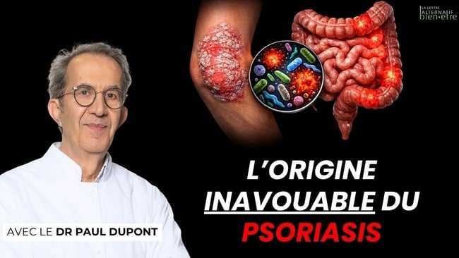 Le VRAI problème du psoriasis et de l'eczéma (ce n’est pas la peau) - Dr Dupont
