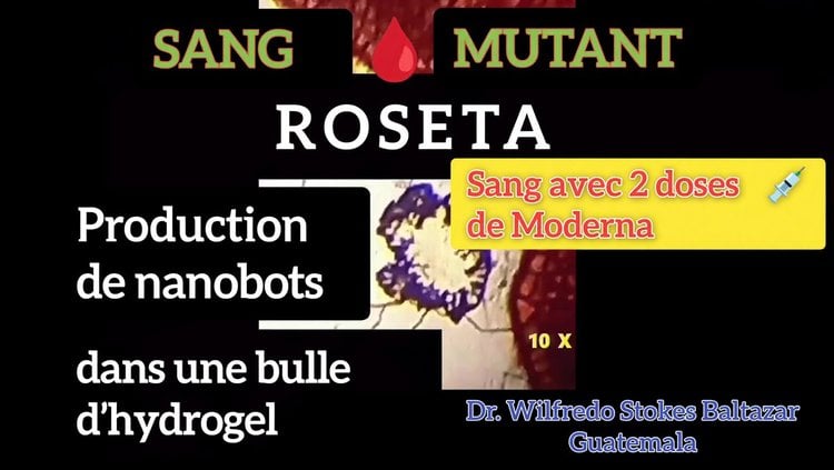 Il ne s'agit en aucun cas de GRAPHÈNE ni de la protéine SPIKE.