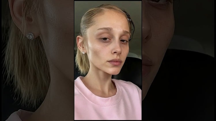 Des célébrités avec le visage Ozempic | Avant vs maintenant